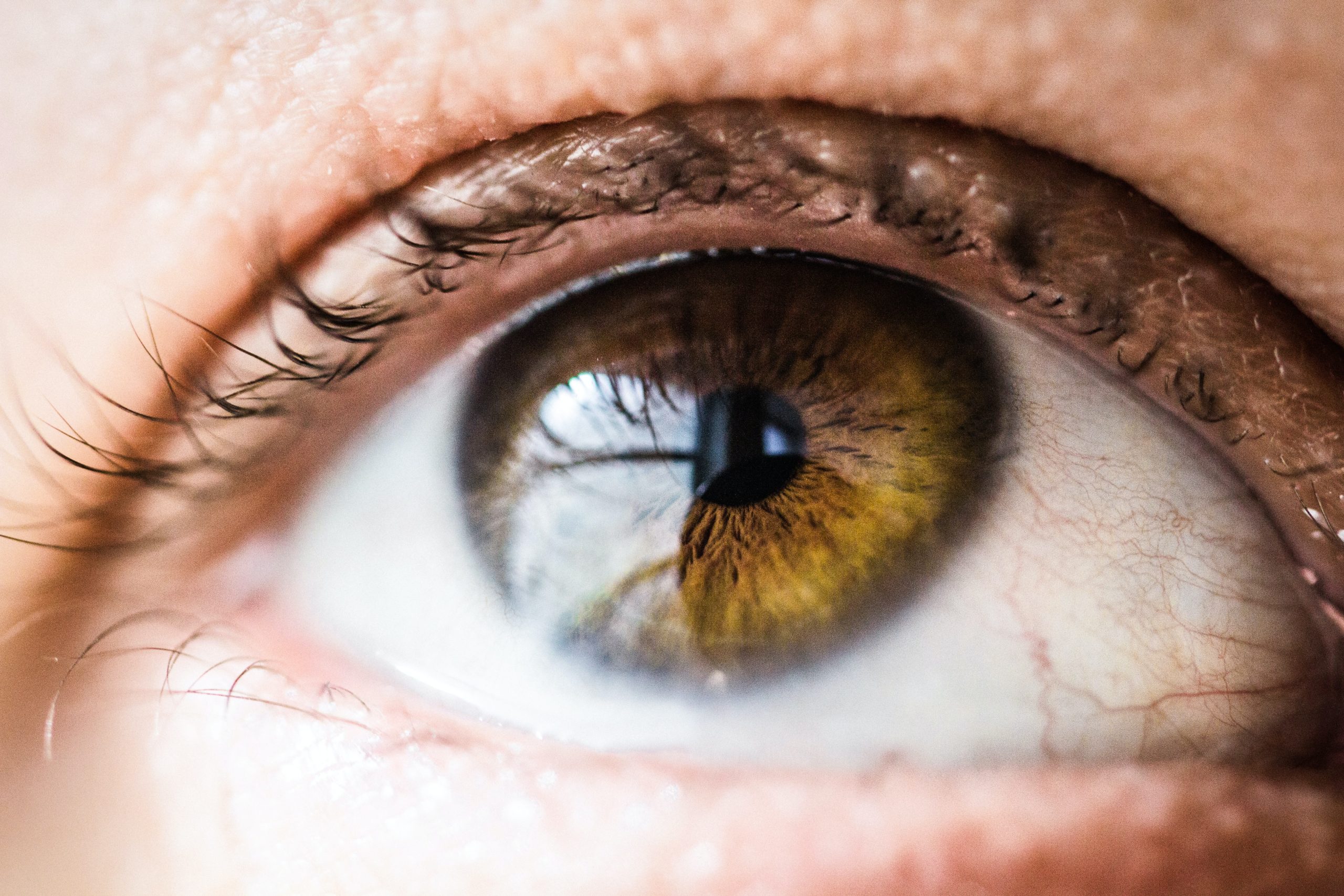 Featured image for “Is Fuchs Dystrophy an Autoimmune Disease? Insights & Research”